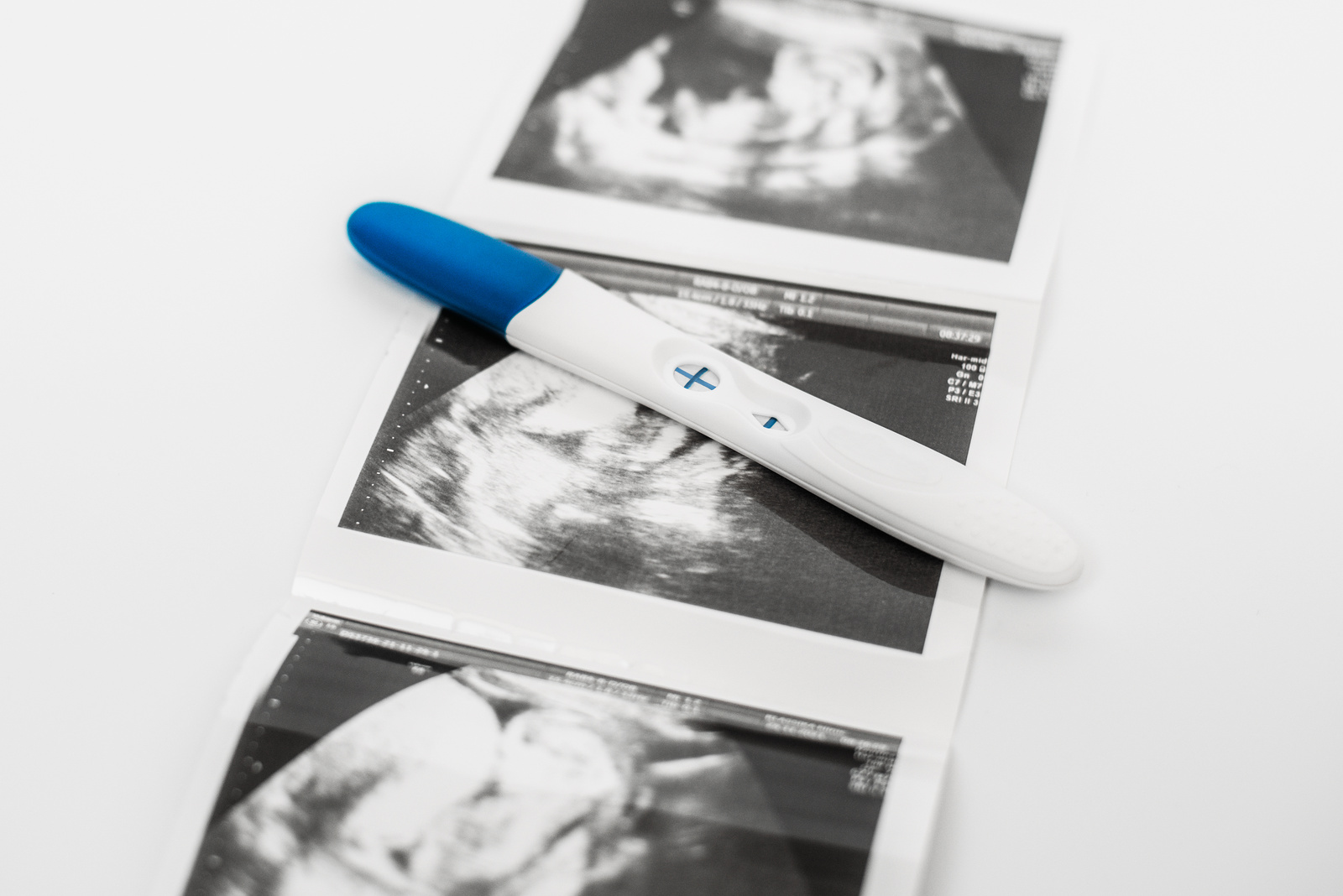 Positive pregnancy test on ultrasound photo. A positive pregnancy test result. Pregnancy test showing a positive result. Ultrasound photos of the child. Copy space